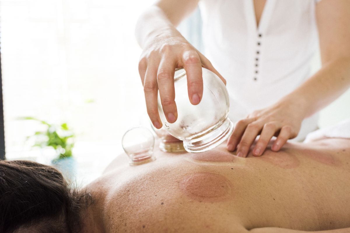 someone undergoing a cupping procedure 